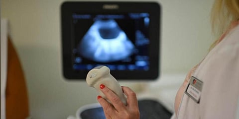 Image of Ultrasound for representational purpose only (File Photo | Reuters)
