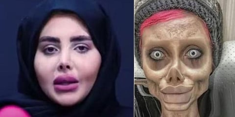 Sahar Tabar has now admitted she never went under the knife and revealed her 'real' ace on TV. (Photos | Twitter)