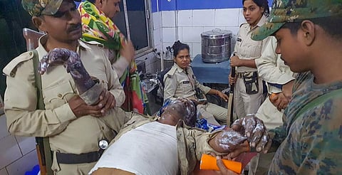 A security personnel who sustained burn injuries while trying to douse a fire in a congested alley undergoes treatment at a hospital, in Aurangabad. (Photo | PTI)