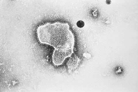 This 1981 photo provided by the Centers for Disease Control and Prevention (CDC) shows an electron micrograph of Respiratory Syncytial Virus, also known as RSV. (Photo | AP)