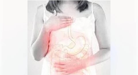 For reprentational purpose