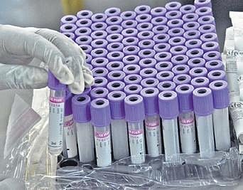 Image used for representational purpose