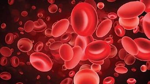 Representational image