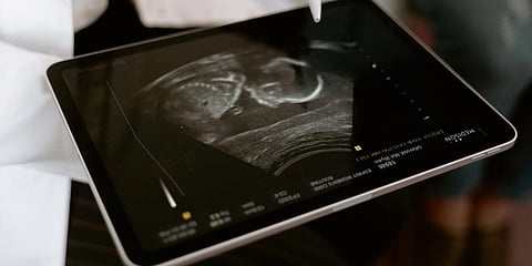 Image used for representational purpose. (Photo | Pexels)