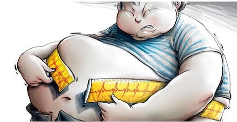 Representative image