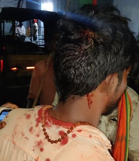 A participant of the Hanuman Shobha Yatra with injured following stone-pelting. (Photo | Express)