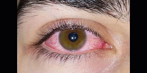 More than meets the eye