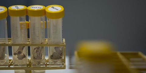 Pieces of bone, used to extract DNA, are seen in vials at the laboratory of the International Commission on Missing Persons in The Hague, Netherlands, Friday, April 8, 2022. (Photo | AP)