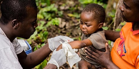 A child affected by monkeypox, sits on his father's legs while receiving treatment at the centre of the International medical NGO Doctors Without Borders in Zomea Kaka. (File photo| AFP)