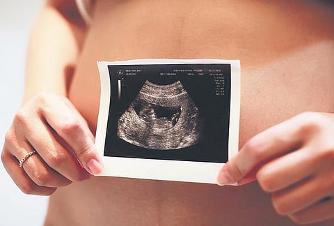 Explaining the ectopic element