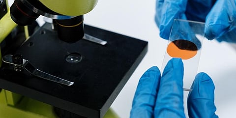 Image used for representational purpose only. (Photo | Pexels)