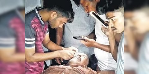 The patient being treated using mobile phone lights in Bhatapada village. (Photo| EPS)