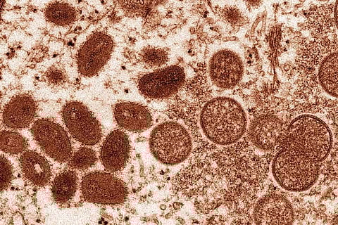 This 2003 electron microscope image made available by the Centers for Disease Control and Prevention shows mature, oval-shaped monkeypox virions. (Photo | AP)