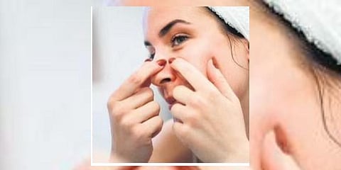 Do you find yourself picking your skin? Here's what you need to know