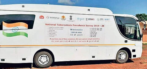 A van being run as nation-wide tuberculosis prevalence survey of Indian Council of Medical Research. (Photo | EPS)