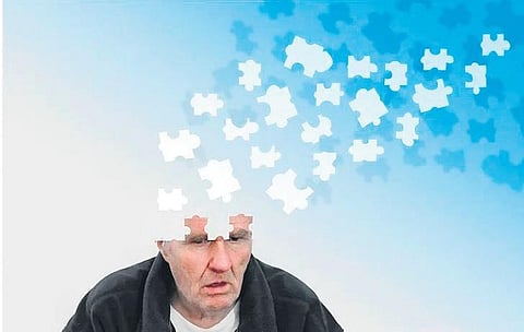 For representational purposes