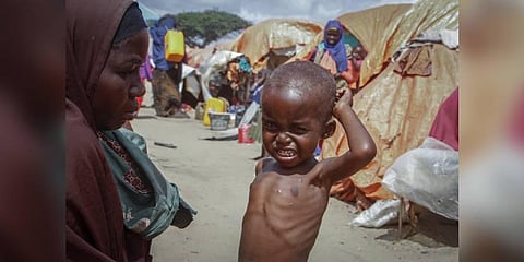 Nurto Mohamud Ali, 45, sits next to her malnourished son Mohamud Hussein, 2, at a camp for the displaced on the outskirts of Mogadishu, Somalia. (Photo | AP)