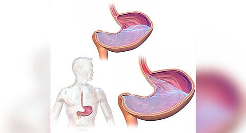 Image used for representational purposes only (Photo | Wikimedia Commons)