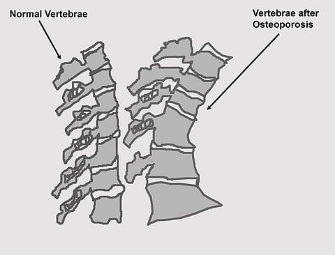 Image used for representational purposes (Photo | Wikimedia Commons)