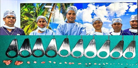 Surgeon Dr Radhamadhab Sahu and his team with the removed stones. (Photo | Express)