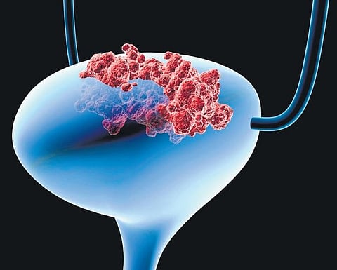 Image used for representational purpose only. (File Photo)