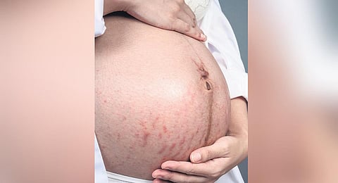 Image used for representational purposes only.