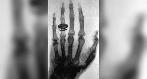 Representative image