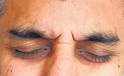 Image used for representational purposes. (Photo | Express)