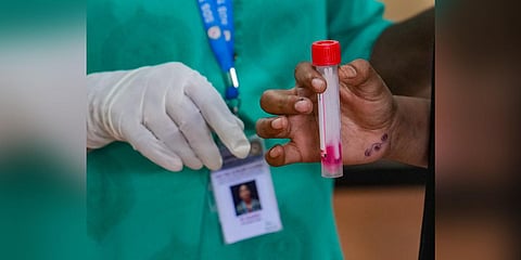 A medical staff conducts covid-19 test at Rajiv Gandhi institute of Chest Disease in Bengaluru (Photo | PTI)