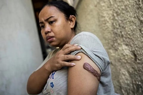 Kartika Puspitasari: Scarred and Traumatised...(Photo | AFP)