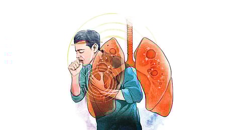 Tuberculosis. (Express illustrations)