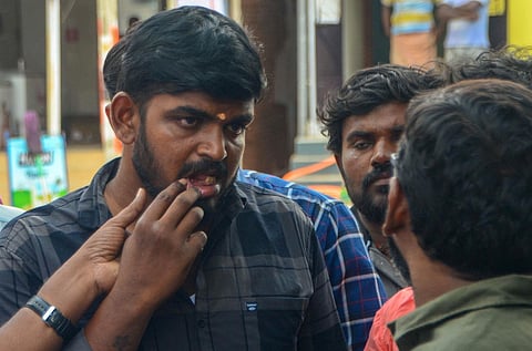 Subash, one of the custodial torture victims in Tamil Nadu's Ambasamudram, shows his damaged teeth. (Photo | V Karthikalagu, EPS)