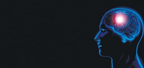 For representational purpose