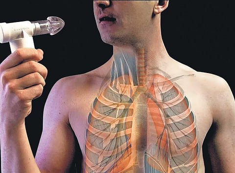 Image used for representational purposes.