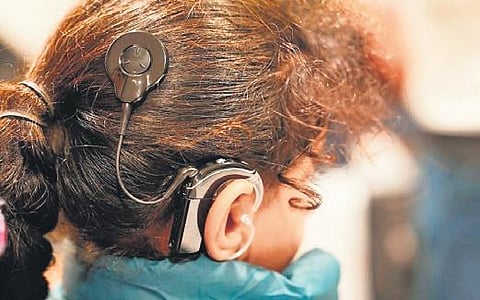 The State Health Agency (SHA) has recently approved over Rs 59 lakh to upgrade cochlear implantation machines for 25 children.