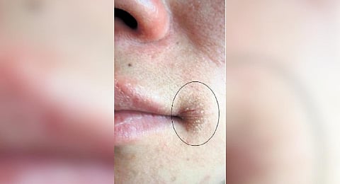 For representational purposes