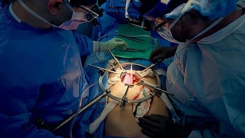 Image used for representational purpose.