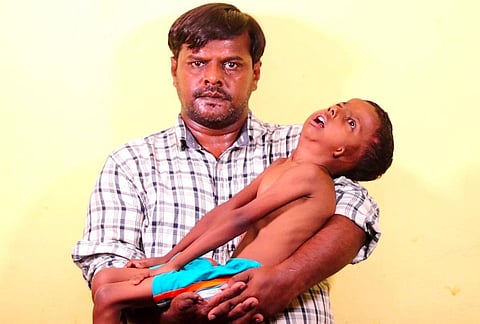 Md Chand Basha with his six-year-old ailing son Md Abdul Rehman Basha. (Photo | Express)