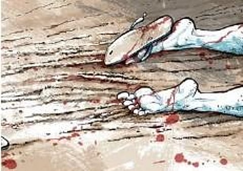 Representational Image.