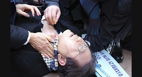 South Korean opposition leader Lee Jae-myung is seen after he was injured in Busan, South Korea, Tuesday, Jan. 2, 2024. (AP)