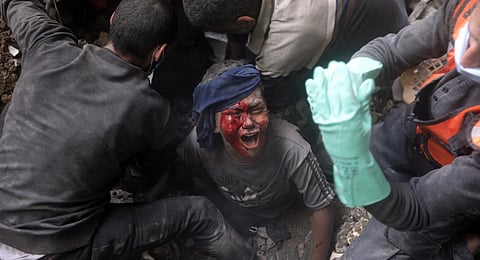 An injured Palestinian boy cries as rescuers try to pull him out of the rubble of a destroyed building following an Israeli airstrike in Bureij refugee camp, Gaza Strip. (Photo | AP)