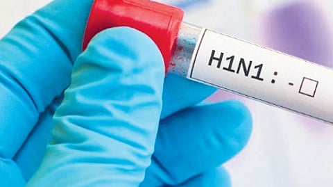 Image used for representation.