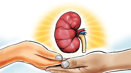 How to manage kidney stones