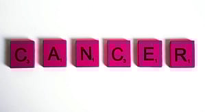 Representational image.