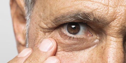 Image used for representational purpose