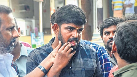 A victim showing the gap formed after his teeth were plucked out.