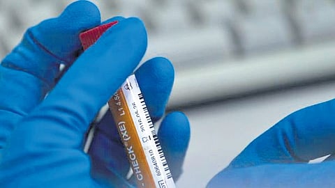 Image used for representational purposes only.