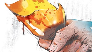 Representative Image.