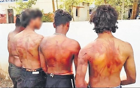 The ex-employees beaten up by Long Drive Cars management in Medipally