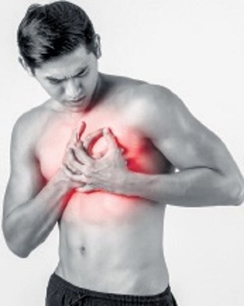 Image used for representation.